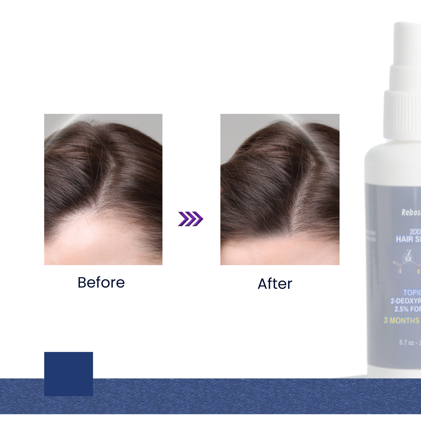 Gel capilar de azúcar desoxirribosa al 2,5 % de grado de laboratorio - 2-desoxi-d-ribosa 2dDR (suministro para 3 meses) 150 ml - Estimula la formación de nuevos vasos sanguíneos en hombres y mujeres