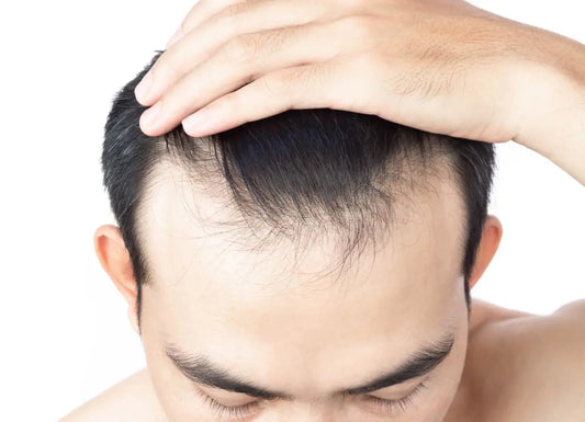 The Power of Deoxyribose Sugar in Thinning Hair: A Breakthrough in Hair Science
